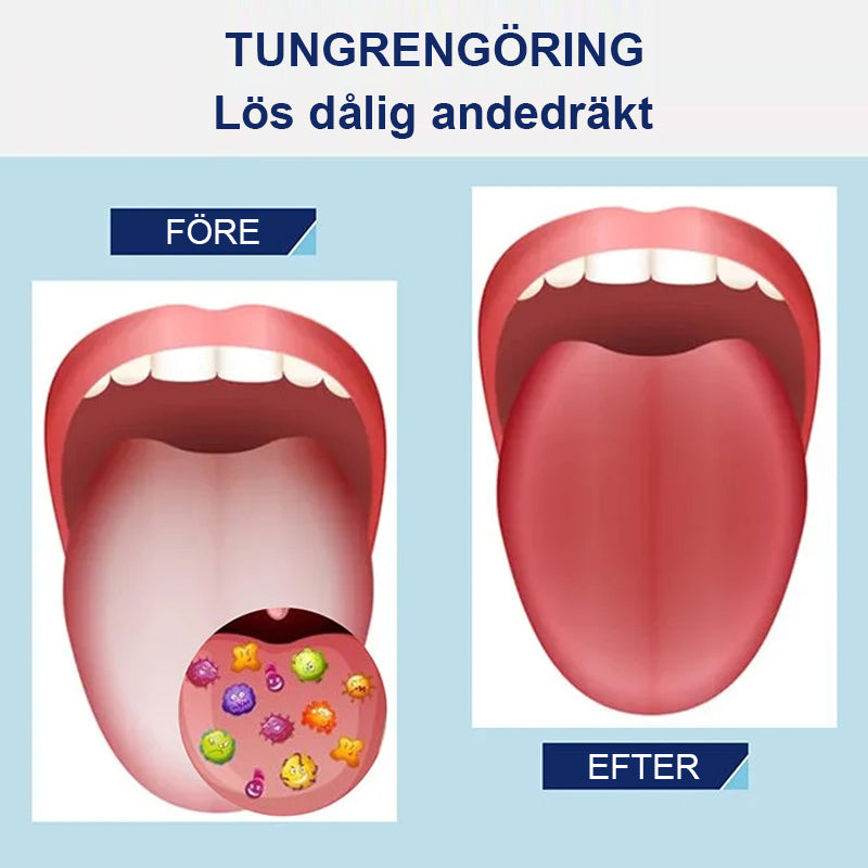 Tungrengörings gelset